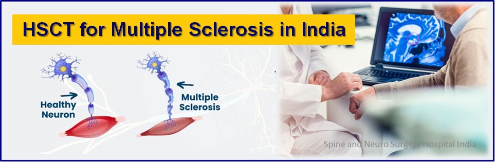 haematopoietic stem cell transplantation for multiple sclerosis in india 